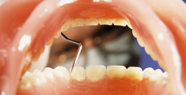 Accede al artículo Tu boca lo merece, sensatez y profesionalidad, ve al dentista